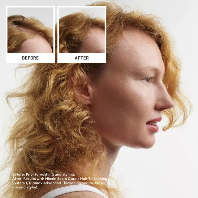 Nioxin Hair System Kit 1 – view 3
