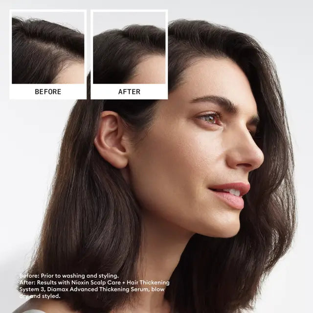 Nioxin Hair System Kit 3 – view 2